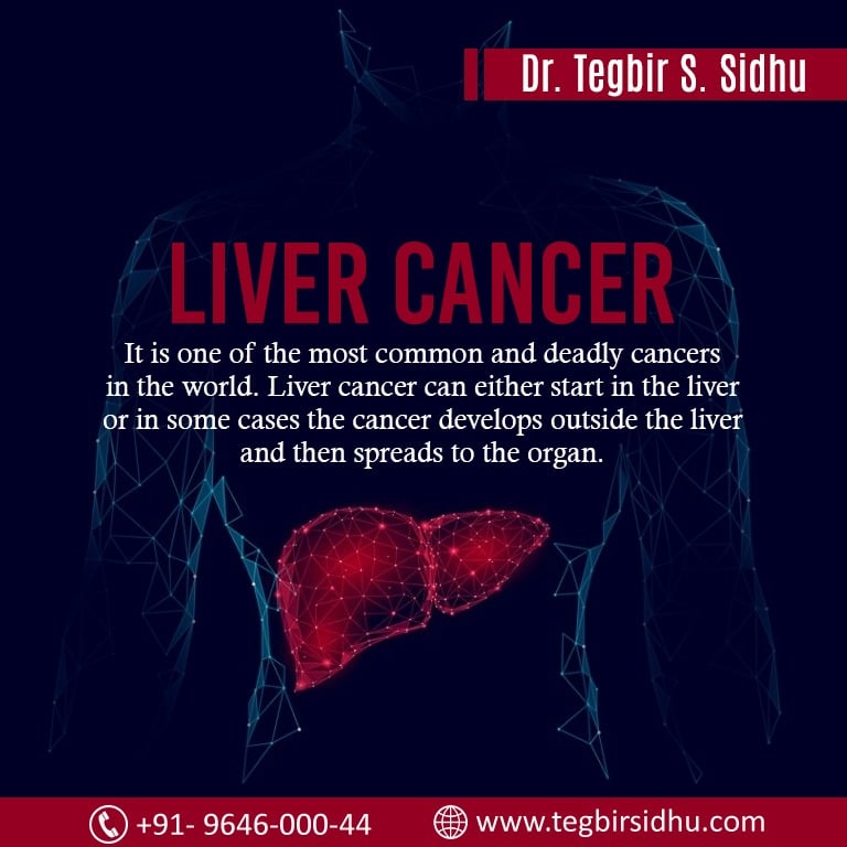Liver cancer treatments best doctor