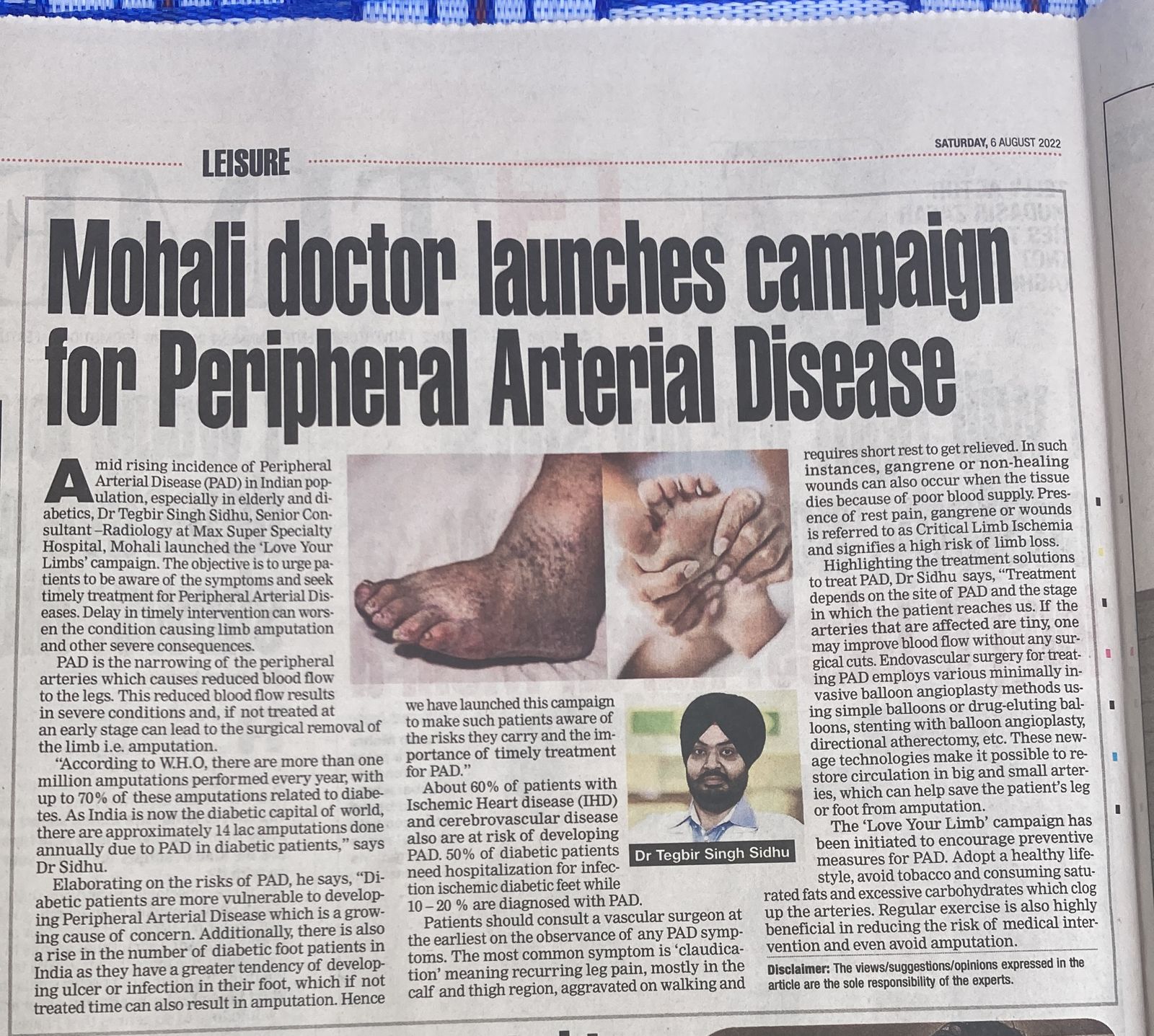 peripheral arterial disease treatment  in chandigarh